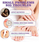 Nail Fungus Spray