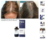 FEG Organic Hair Growth Treatment Oil